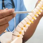 What To Do After A Spinal Cord Injury In California