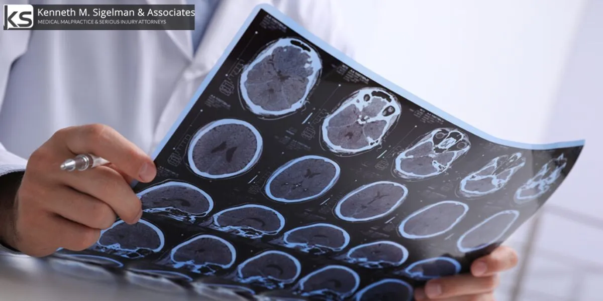 El mejor abogado especializado en lesiones cerebrales traumáticas en Vista