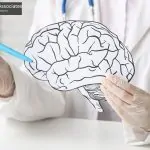 Deterioro cognitivo tras una lesión cerebral traumática en California