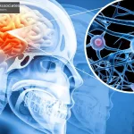 Cognitive Impairment Following Traumatic Brain Injury In California