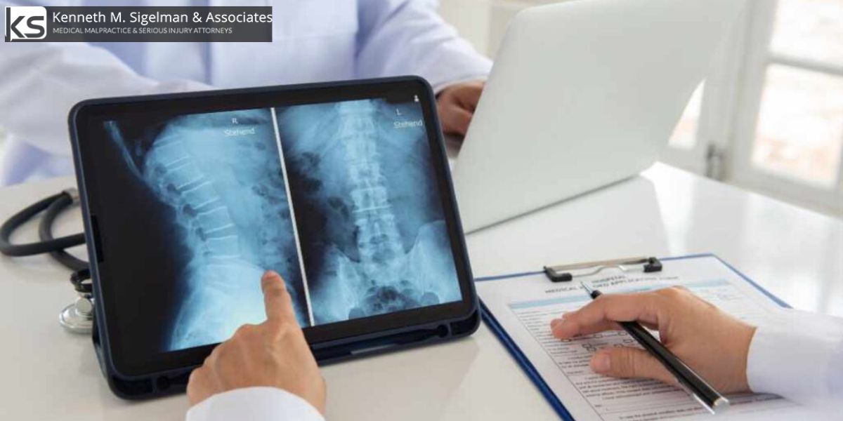 Best National City Spinal Cord Injury Lawyer
